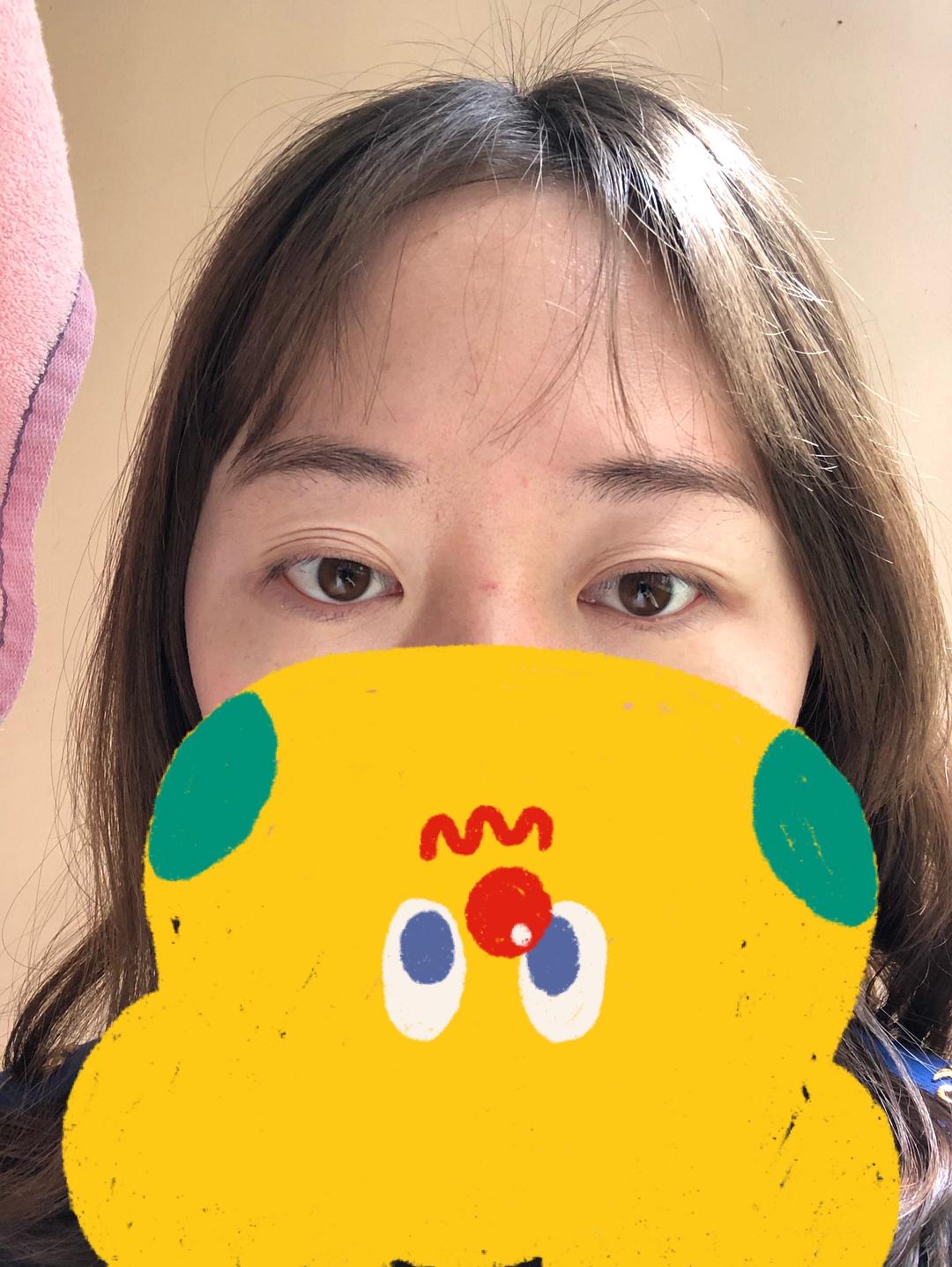 眼睛肌无力可以锻炼吗_眼部肌无力玩手机游戏_眼肌无力可以锻炼好吗