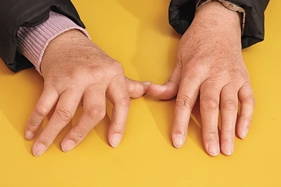 玩手机打游戏大拇指疼-玩手机游戏别再疼大拇指!这些小技巧帮你轻松应对(图2) 拇指玩手机痛_玩手机打游戏大拇指疼_玩手游大拇指痛