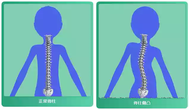 玩手机游戏坐姿_打游戏坐姿_坐姿玩手机游戏的危害