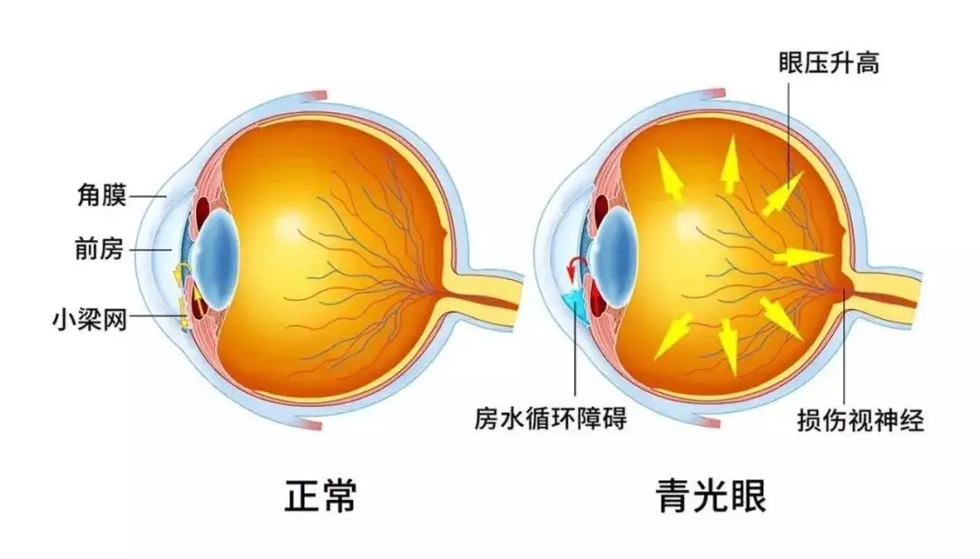 眼睛玩手机对眼了怎么办_玩游戏把眼睛玩坏了_玩游戏的手机对眼睛的伤害