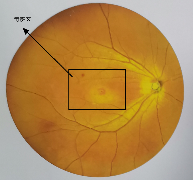 玩游戏把眼睛玩坏了_眼睛玩手机对眼了怎么办_玩游戏的手机对眼睛的伤害