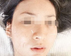 治面瘫游戏,趣味游戏助力面瘫康复之旅(图3) 治面瘫游戏,趣味游戏助力面瘫康复之旅(图3)