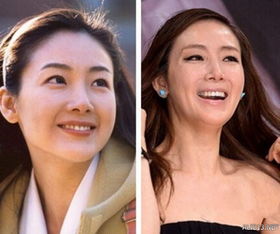 明星整容游戏,揭秘虚拟世界中的整容游戏魅力(图2) 明星整容游戏,揭秘虚拟世界中的整容游戏魅力(图2)
