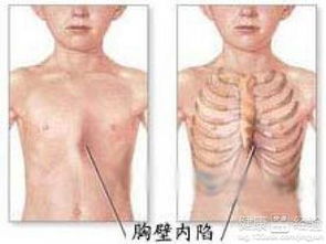 挠肋骨游戏,锻炼身体两不误(图1) 挠肋骨游戏,锻炼身体两不误(图1)