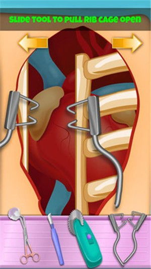 心脏手术游戏,心脏手术游戏体验揭秘(图2) 心脏手术游戏,心脏手术游戏体验揭秘(图2)